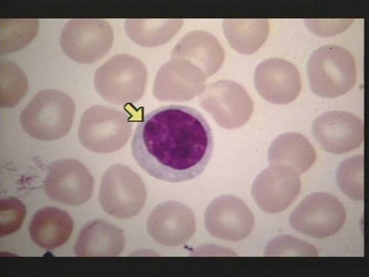 <p>(also, white blood cell) colorless, nucleated blood cell, the chief function of which is to protect the body from disease</p>