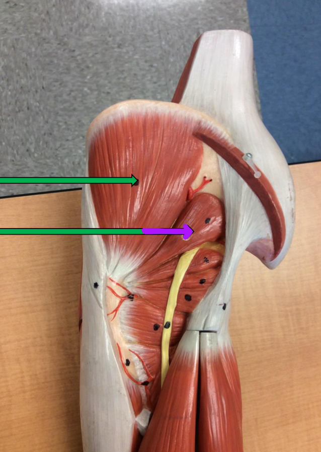 <p>Identify this muscle?</p>