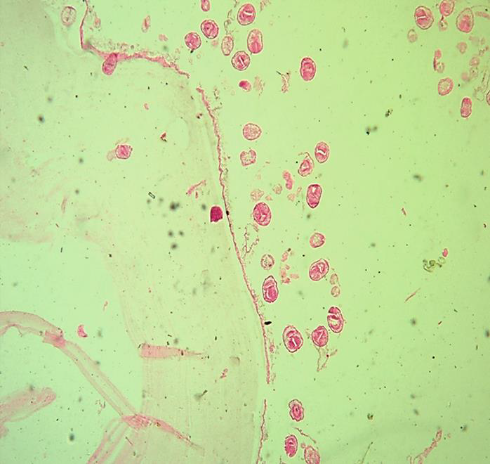 <p><strong>Name the parasitic stage.</strong></p><p><strong>Mention special characteristics of the stage.</strong></p><p><strong>Name the intradermal test used for diagnosis of this disease.</strong></p><p><strong>What is the definitive diagnostic method?</strong></p>