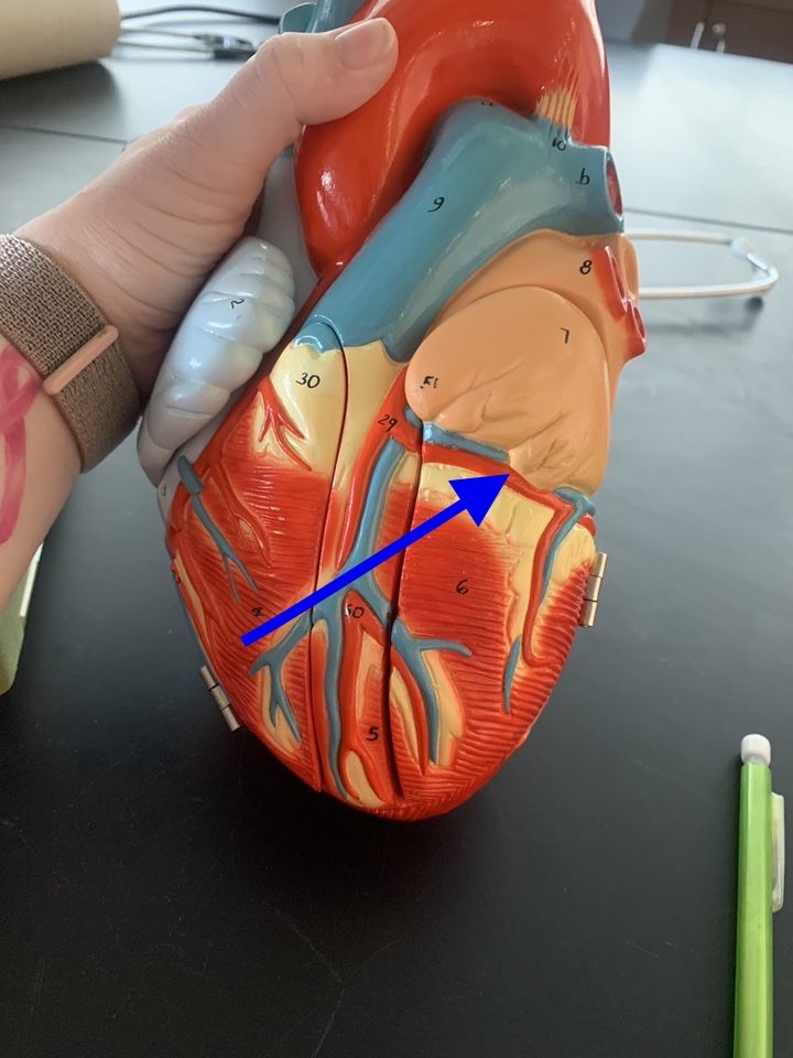Name the heart structure.