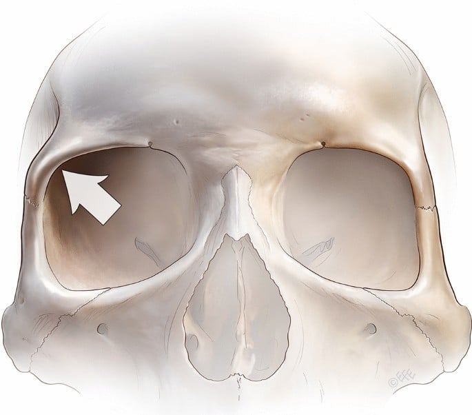<p>the ridge (part of the frontal bone) </p>
