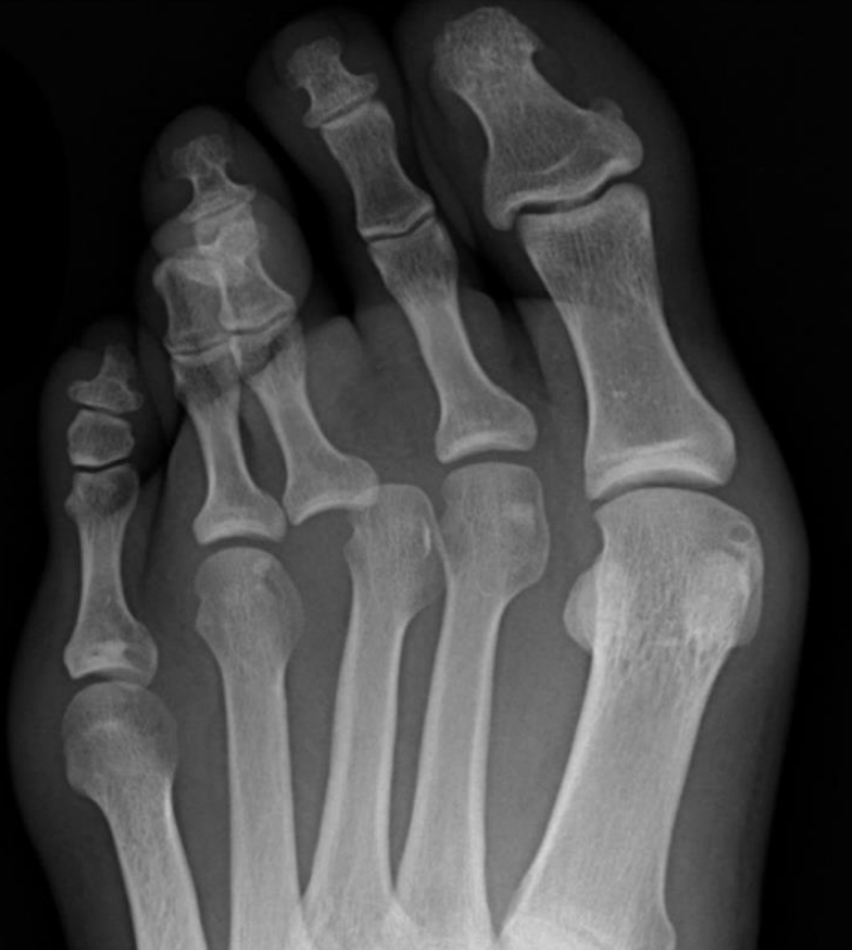 <p>describe the scan + indication</p>