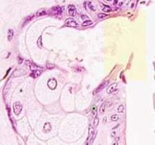 <p>Holocrina. (Gl. sebáceas)</p>