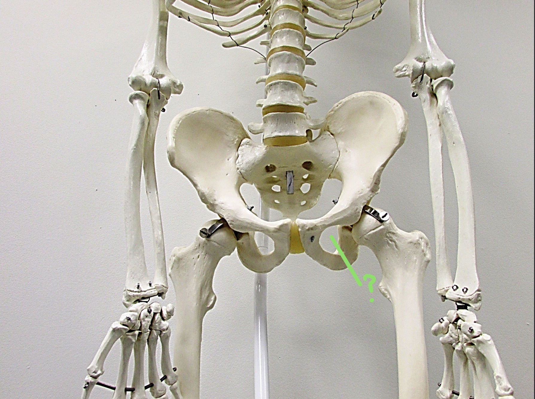 <p>Determine the part of the Coxa/Sacrum highlighted</p>