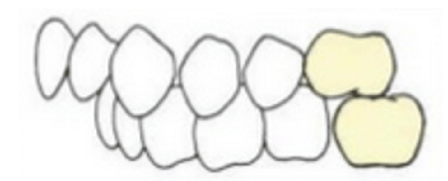 <p>ID the class of occlusion:</p>