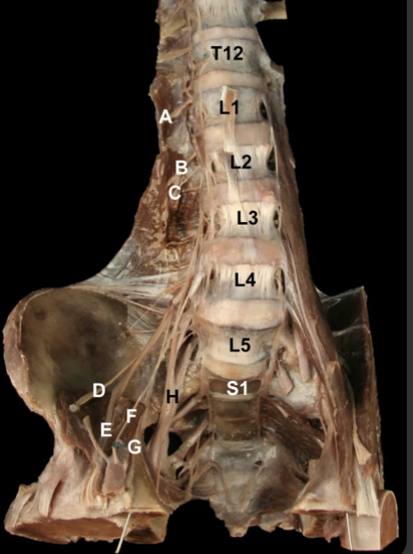 <p>A lesion to “G'“ results in weakness of what movement of the lower leg?&nbsp;</p>