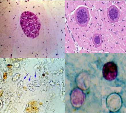 <ul><li><p><span>9-16 microns</span></p></li><li><p><span>Infects various mammals</span></p></li><li><p><span>Human: Definitive Host</span></p></li><li><p><span>Pig: Intermediate Host</span></p></li><li><p><span>Acquired from improperly cooked or raw beef or pork</span></p></li></ul><p></p>