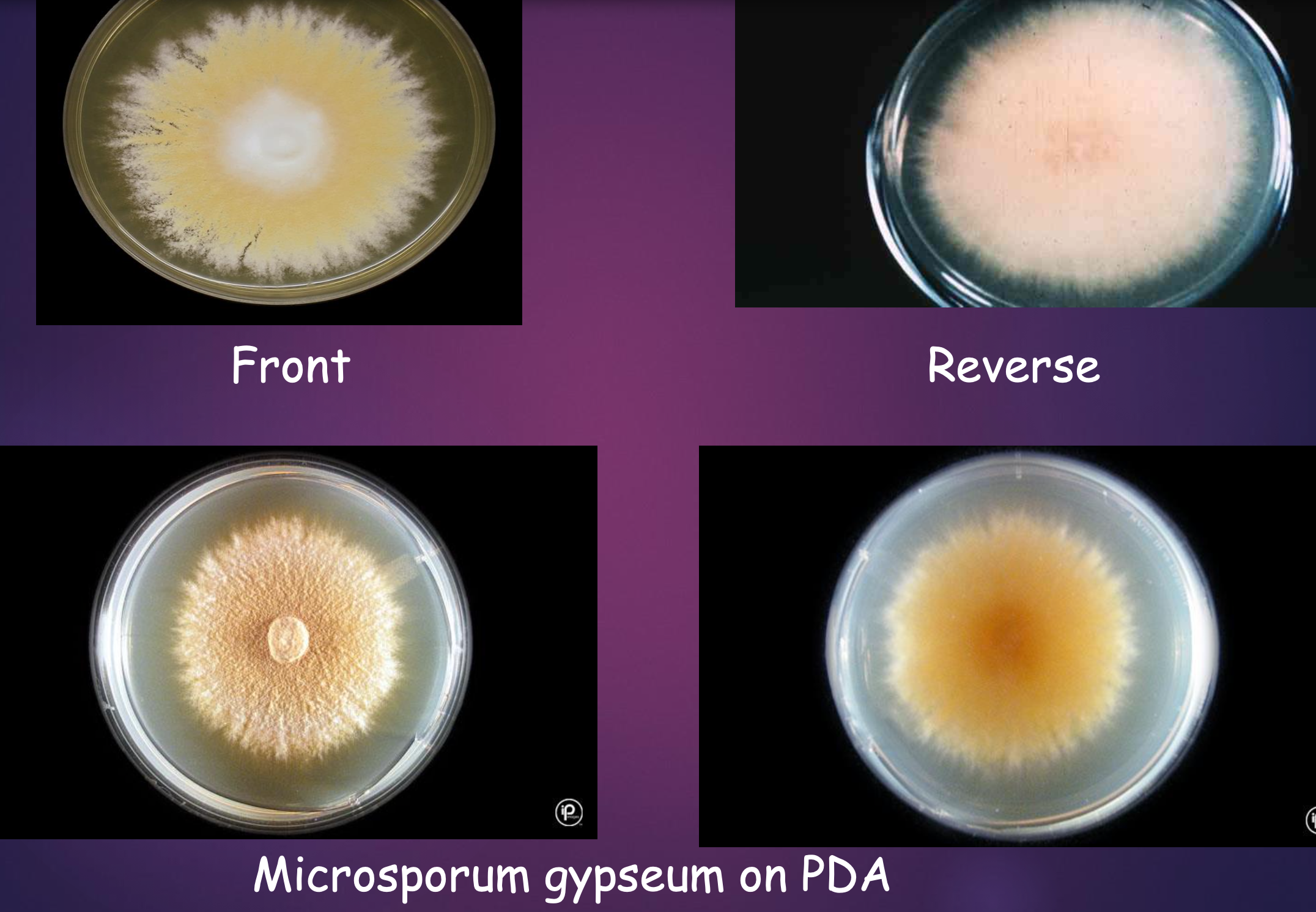 <p>Dermatophytes microscopic &amp; colony ID: Microsporum gypseum.</p><p>Label the structures found in dermatophyte microscopic image</p>