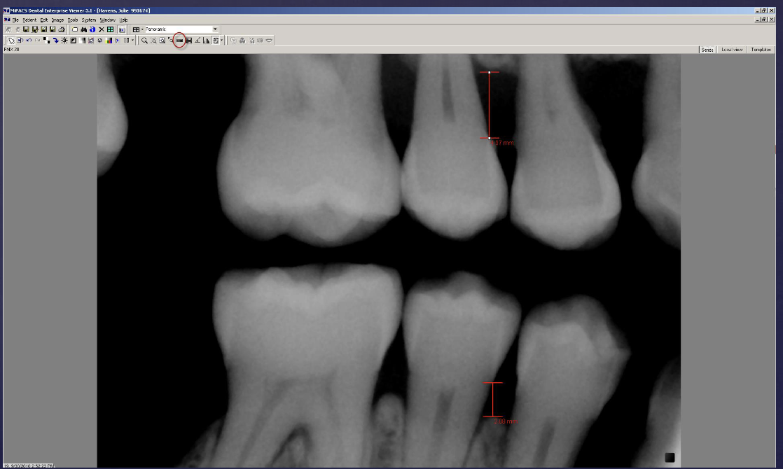 <p>what type of digital processing is this?</p>