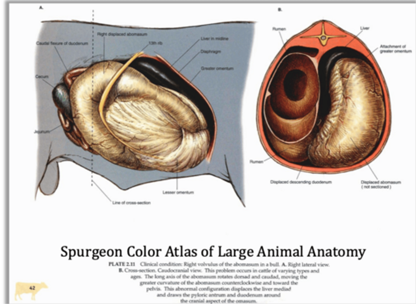 <p>this form of displacement is less common but is more clinically serious as the long axis of the abomasum rotates dorsally and caudally creating a high risk of volvulus and blood supply compromise</p>