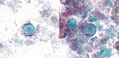 <p>Identify this organism</p>