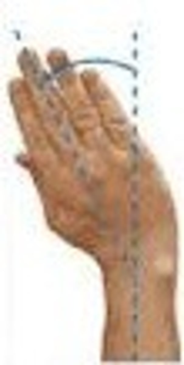 <p>abduction movement at the wrist of thumb side of hand toward the forearm</p>