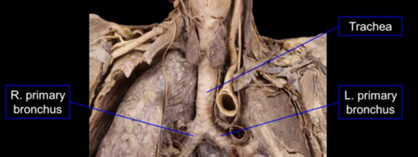 <p>windpipe</p><p>- carina &amp; trachealis muscle</p>