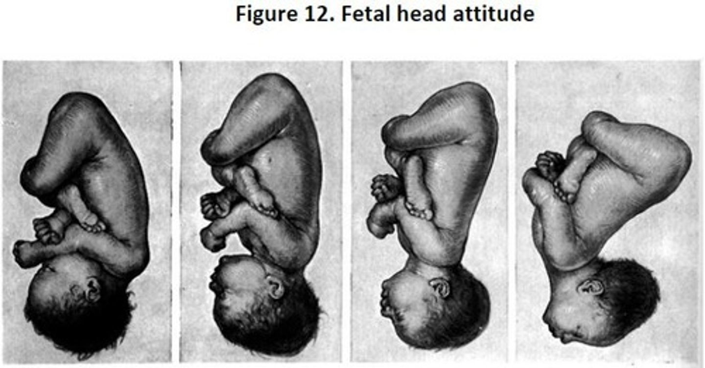 <p>-the relationship of the fetal parts to one another.</p><p>-the fetal attitude can be flexion or extension.</p>