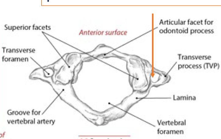 <p>Identify this structure and anatomical significance</p>