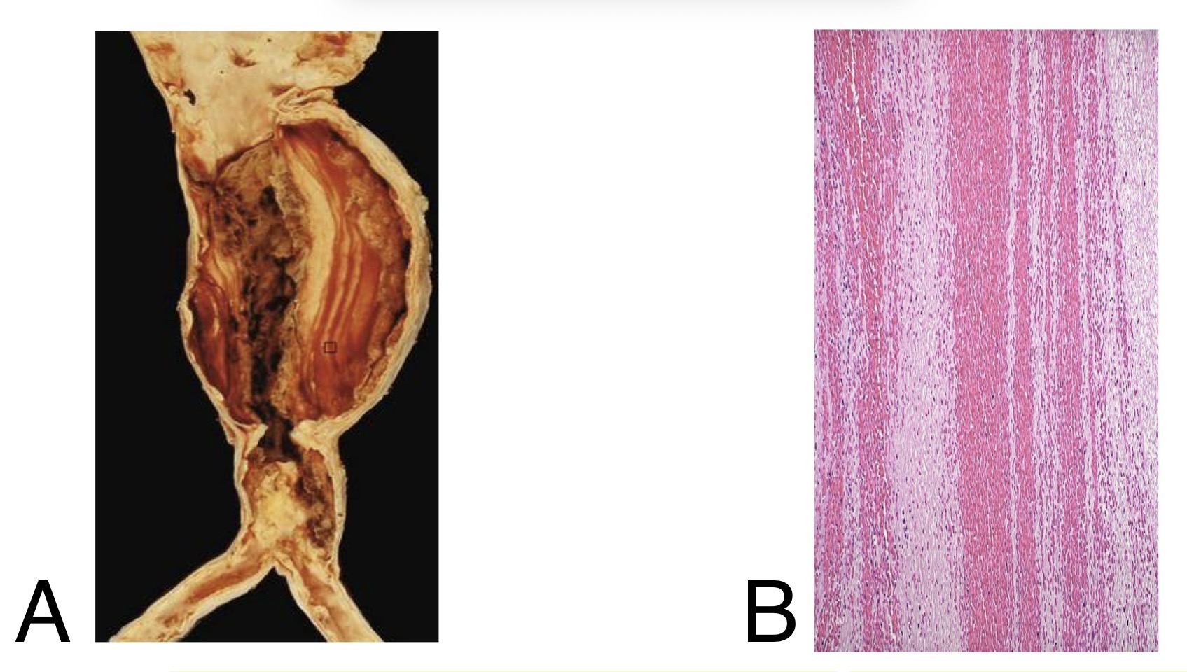 <p><span>1. Identify A. </span></p><p style="text-align: justify;"><span>2. Describe B. </span></p>