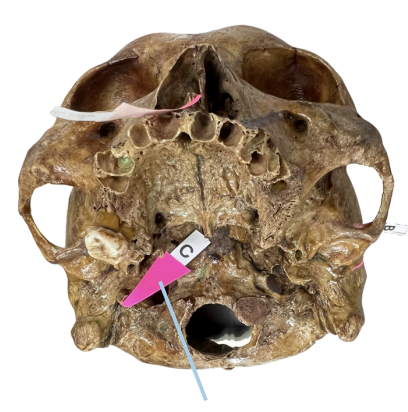 <p>Identify the structure of the skull labelled as C.</p>