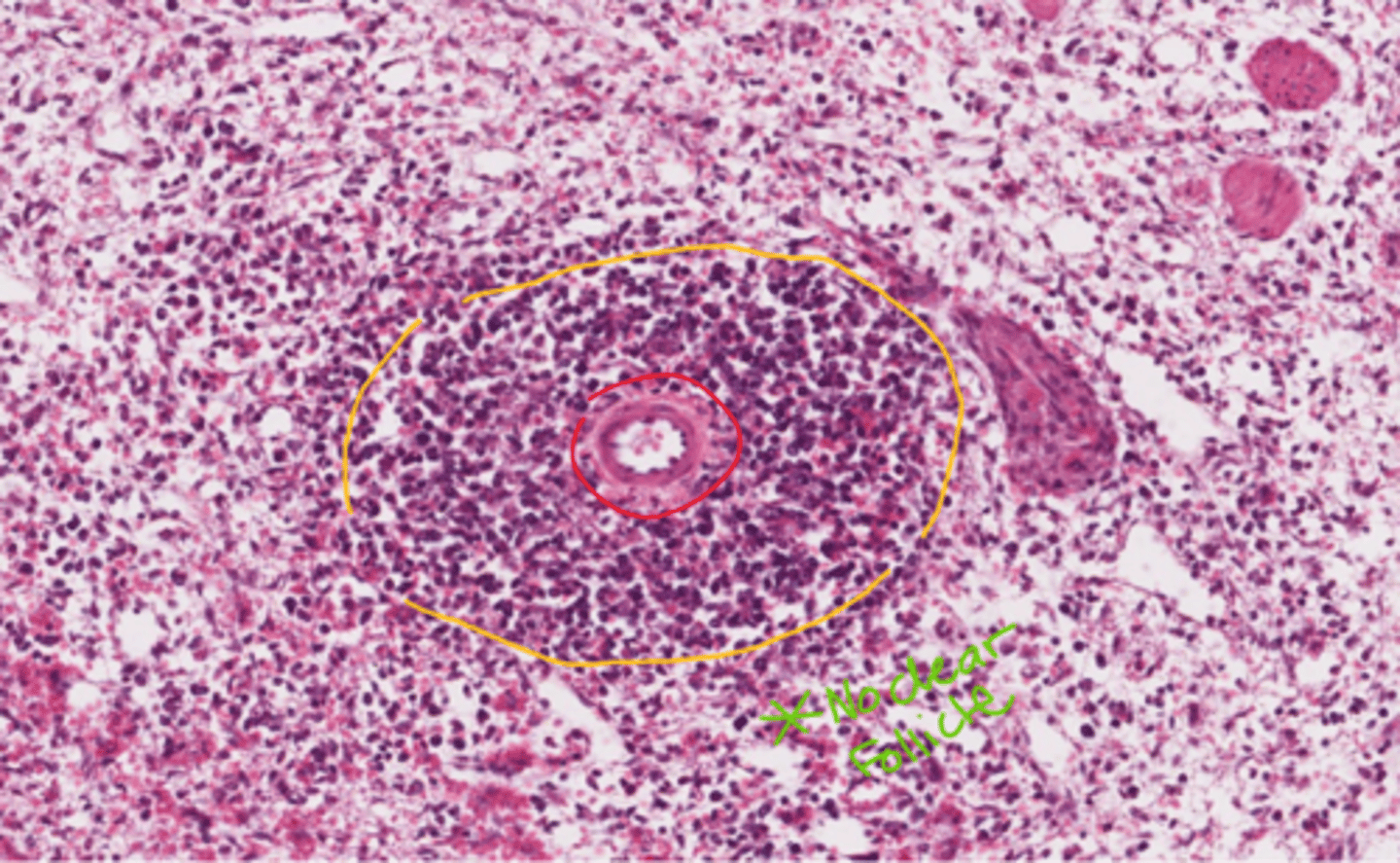 <p>theres not really any green to indicate a follicle... does that mean this one doesnt have a follicle?</p>