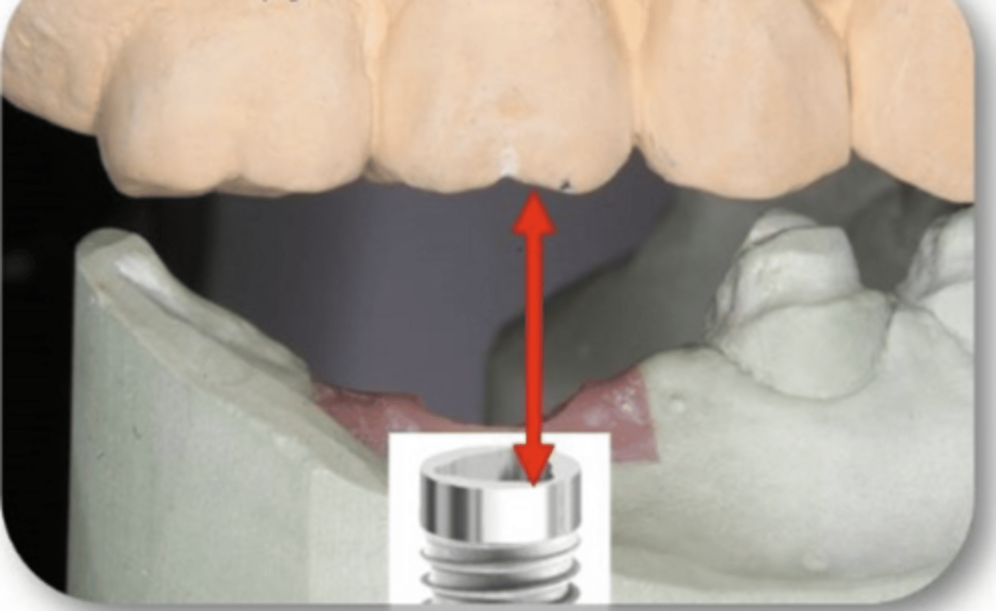 <p>What is the red arrow measuring?</p>
