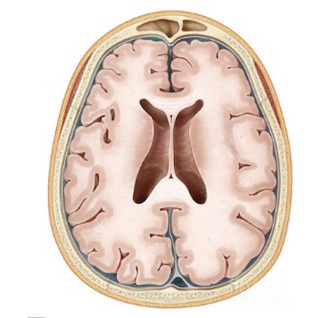 <p>this is a cross-section in what plane ?</p>