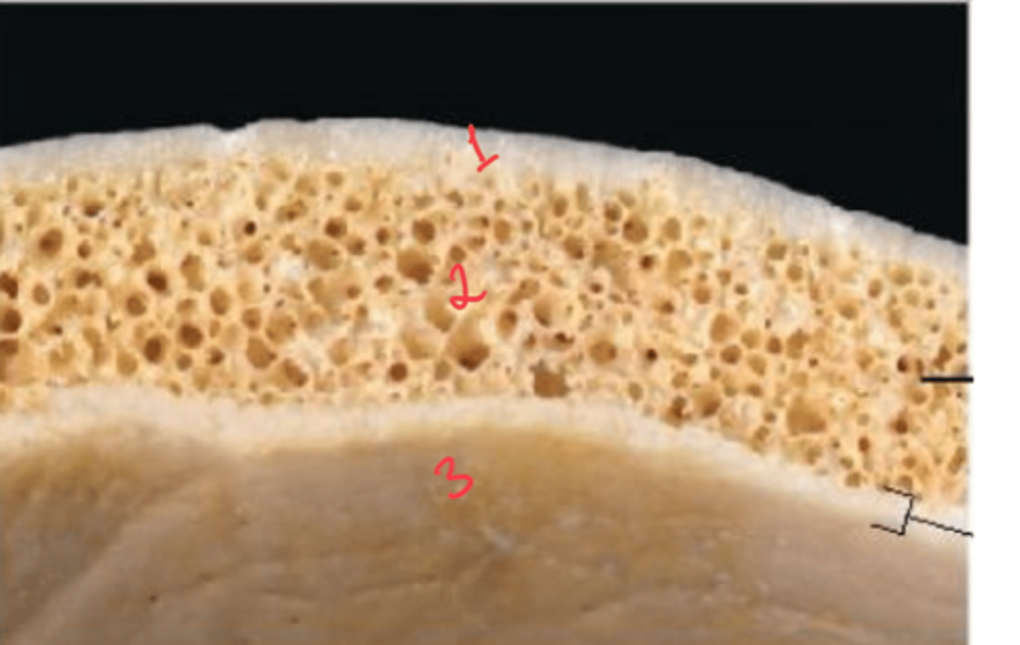 <p>What are the Layers of bone in skull?</p>