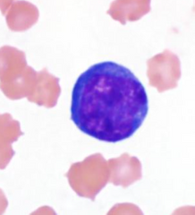 <p>What type of lymphocyte is this?</p>