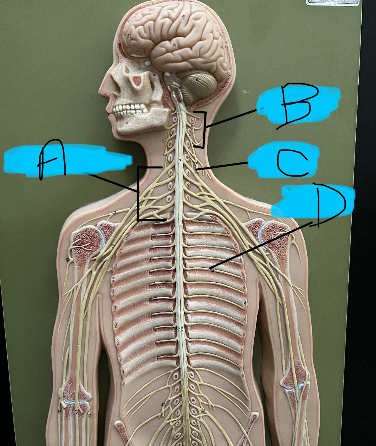 D