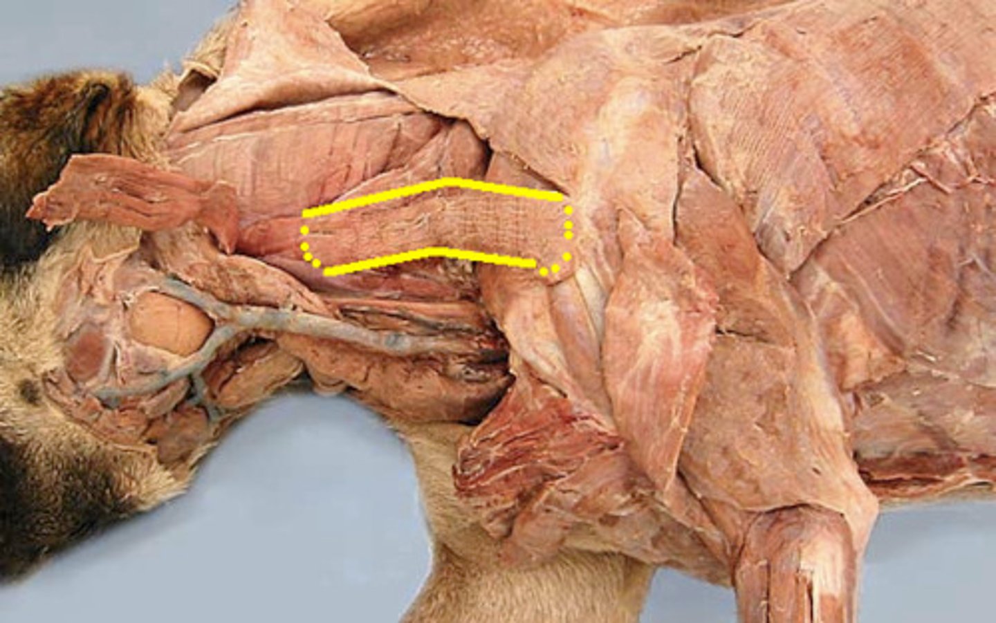 <p>What muscle is this?</p><p>Origin?</p><p>Insertion?</p><p>Function?</p><p>Innervation?</p>