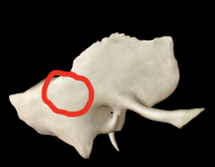 <p>What part of the temporal bone is this?</p>
