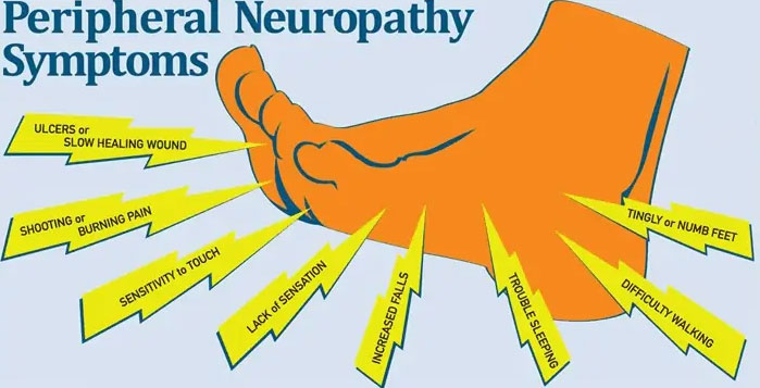 <p>Peripheral neuropathy (nausea vomiting. dizziness while standing or changing position from sitting to standing control bowel and bladder functions. irregular heart rate. difficulty swallowing.)<br></p>
