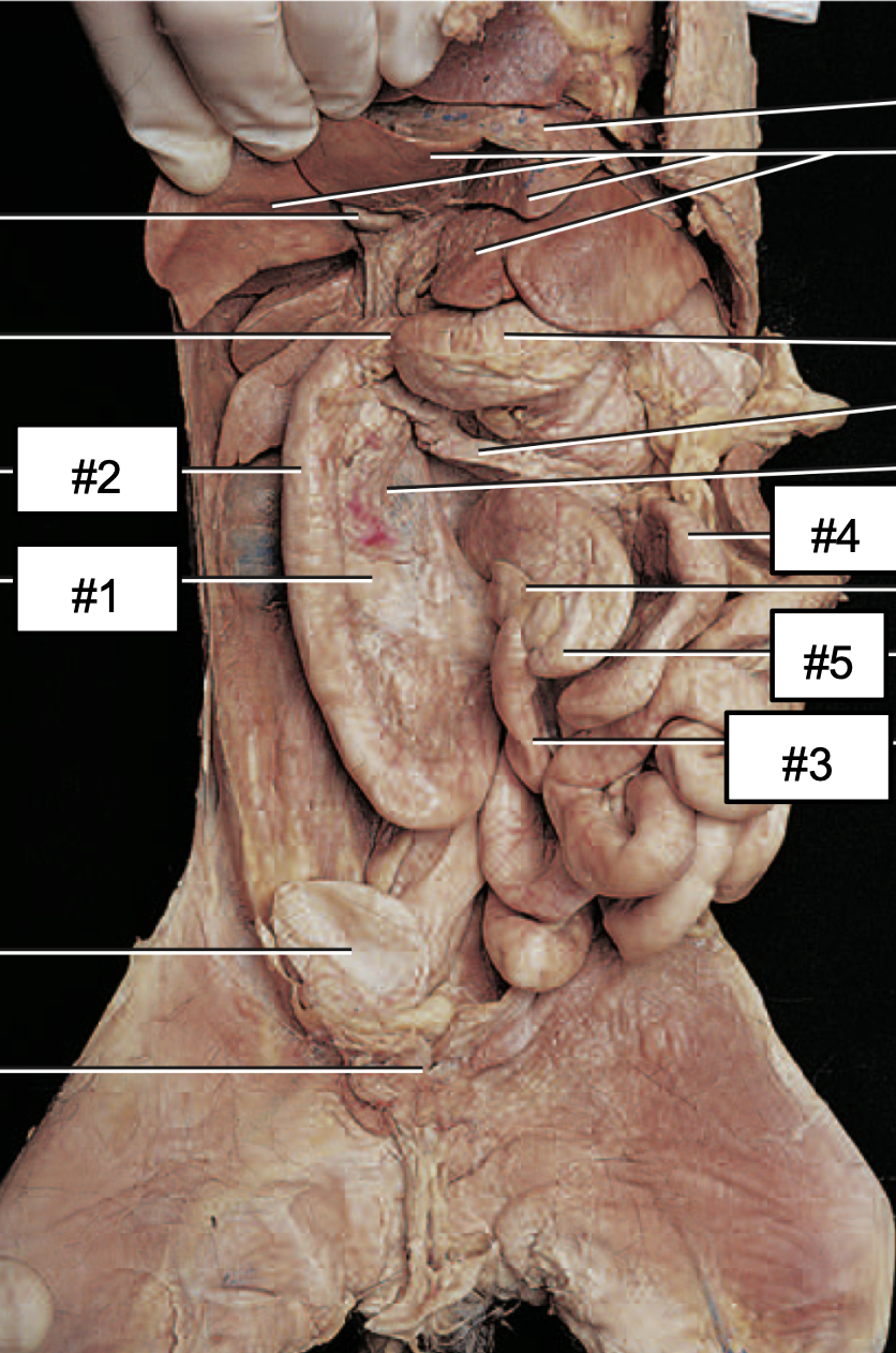 <p>#2?</p>