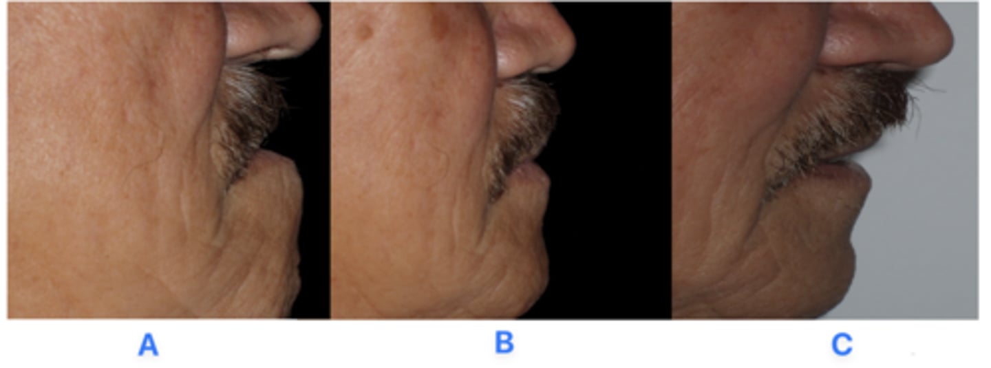 <p>What are the difference between the three images?</p>