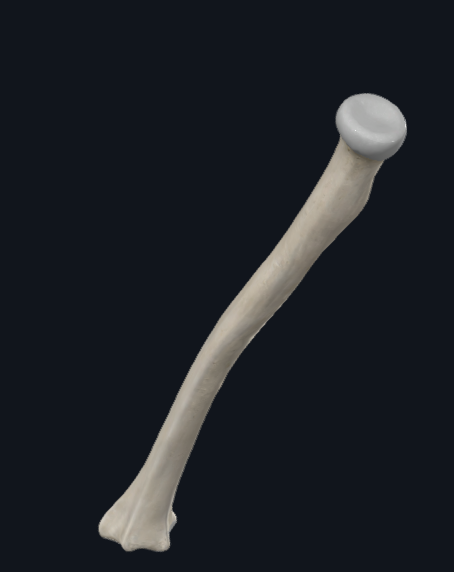 <p>What bone is this?</p>