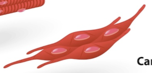 <p>What type of muscle is this? </p>