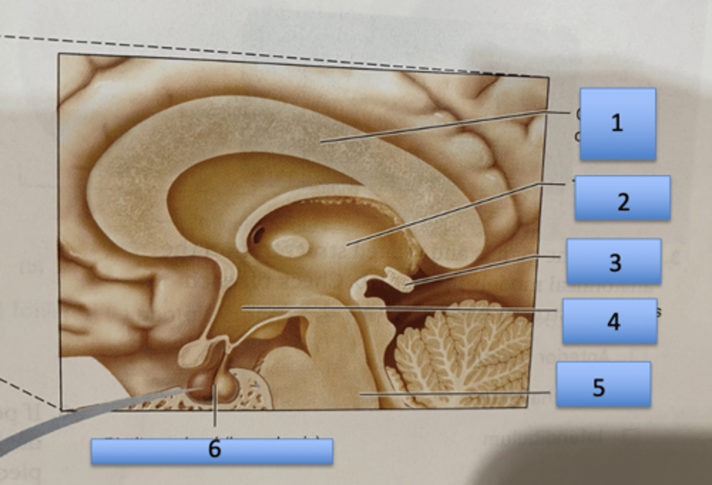 <p>1. Corpus Callosum</p><p>2. Thalamus</p><p>3. Pineal gland</p><p>4. Hypothalamus</p><p>5. Brain stem</p><p>6. Pituitary gland (hypophysis)</p>