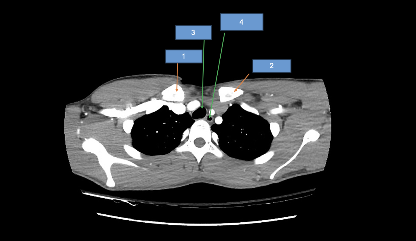 <p>3</p>