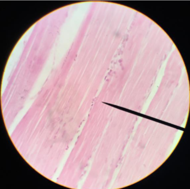 <p>What is this type of muscle?</p>