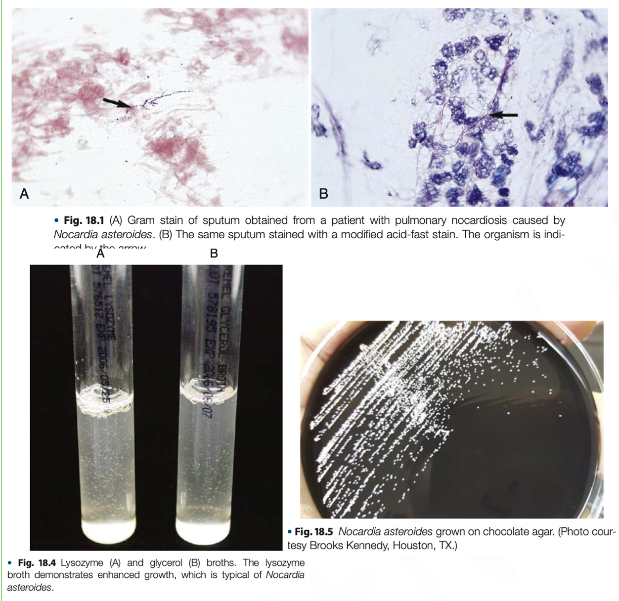 <p><em>Nocardia cyriageorgica</em></p><p><em>Nocardia brasilinesis</em></p><p><em>Nocardia otitidis cavarium</em></p><p><strong>COB</strong></p>