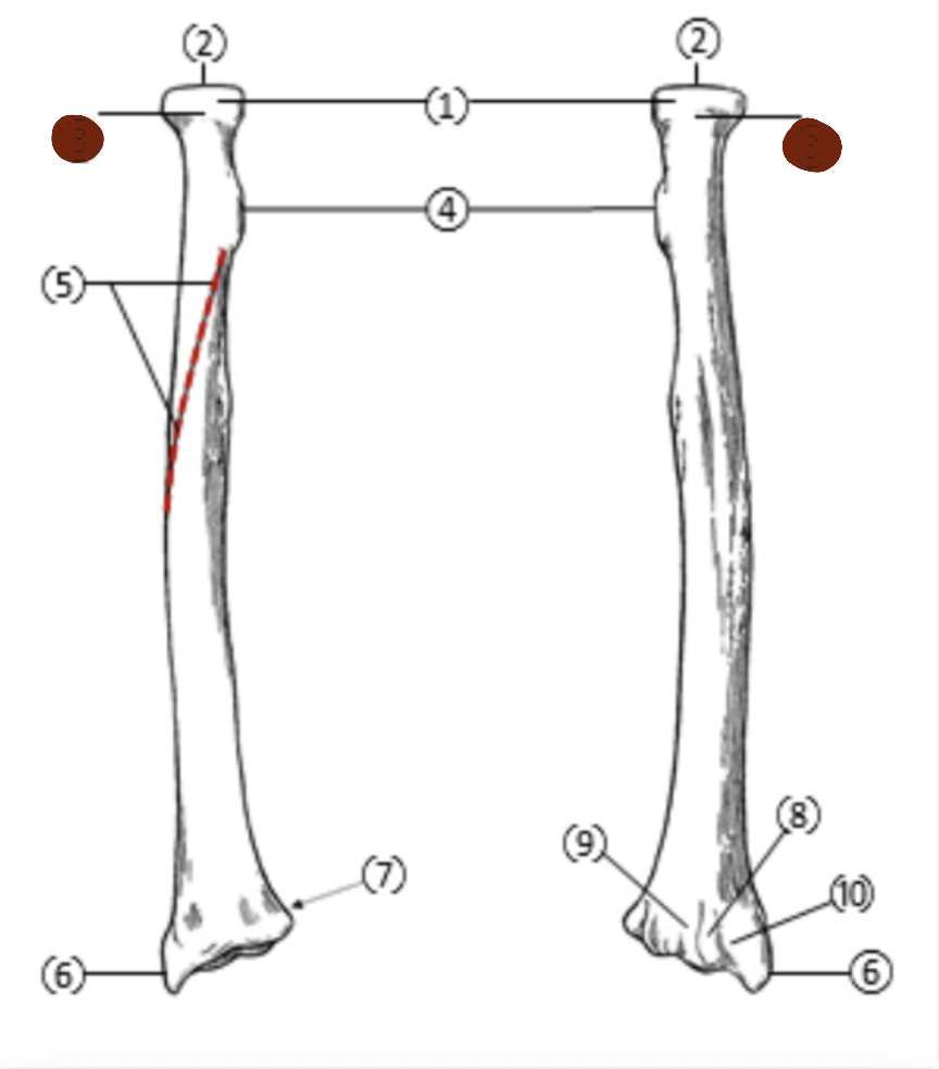 <p>On the Proximal end of the radius, which part is highlighted (3)?</p>