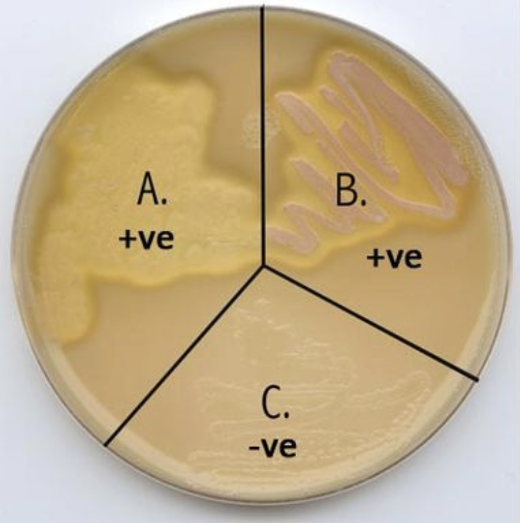 <p>Lipase is present</p>