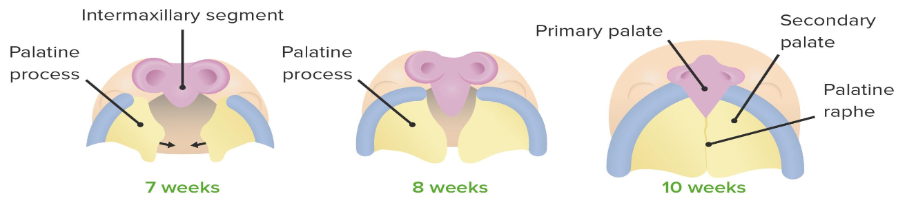 <ul><li><p>PALATINE PLATES (process) of the maxillary prominence, begin to grow medially (4-6 weeks)</p></li><li><p>PALATINE PLATES fuse together, once the tongue leaves the space, forming the SECONDARY PALATE (6-8 weeks)</p></li><li><p>THE SECONDARY PALATE is fused with the PRIMARY TRIANGULAR PALATE, with the INCISIVE HOLE being THE UNION BETWEEN THEM (10 weeks)</p></li></ul><p></p>