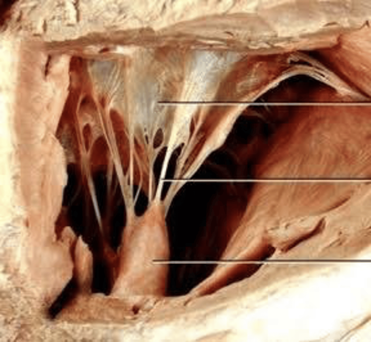 <p>"heartstrings" that keep valves from prolapsing and are attached to the papillary muscles.</p>