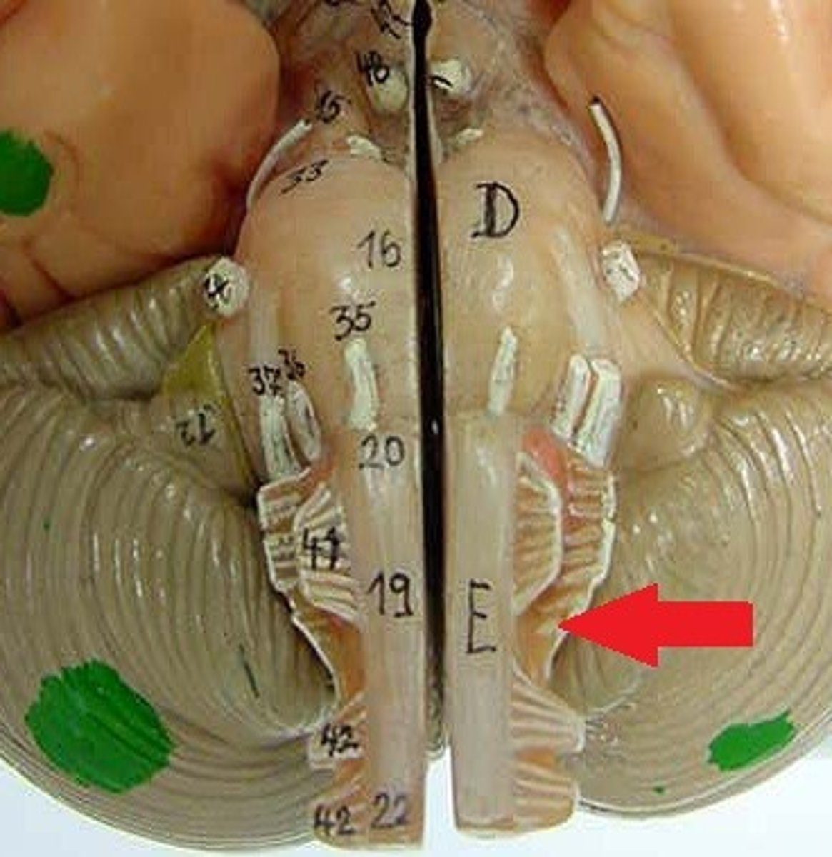 <p>Motor - trapezius and sternocleidomastoid (head/neck movement)</p>