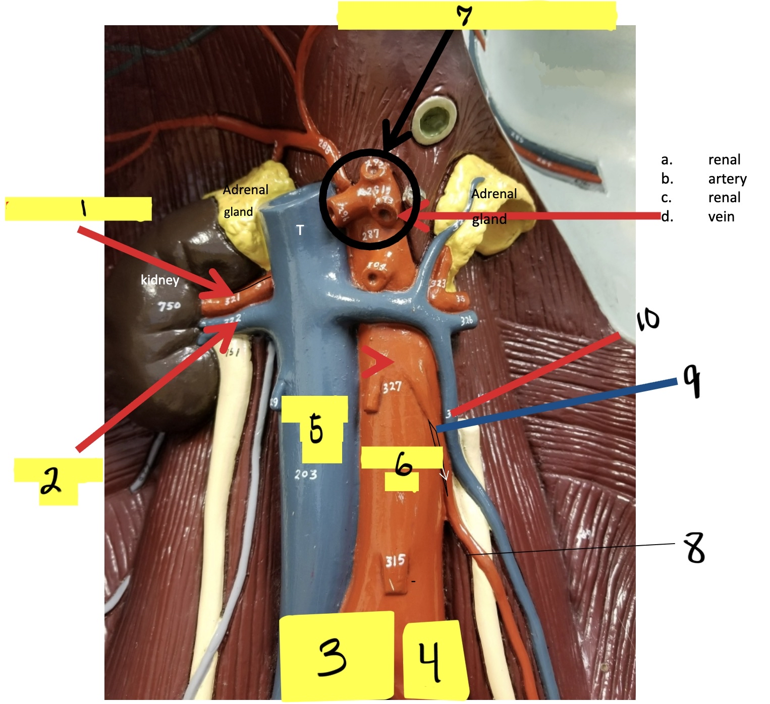 <p>what is #8 in this image? (<span><span>supplies large intestine)</span></span></p>