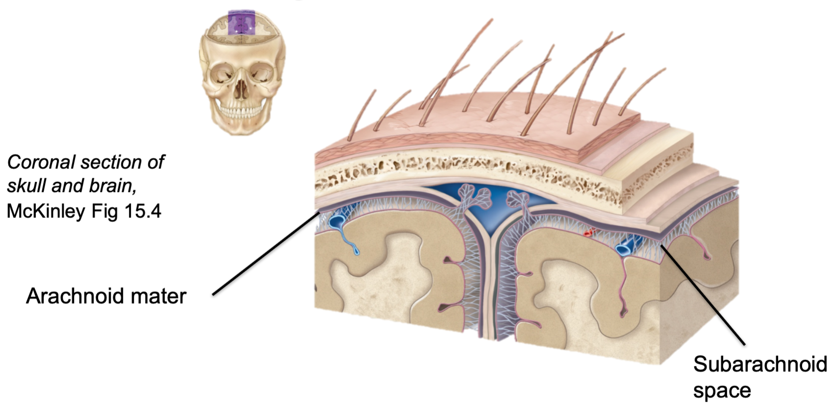 1. Middle meninges layer 
2. Looks like spiderweb 
3. Includes subdural space that can fill with fluid or blood due to trauma/disease