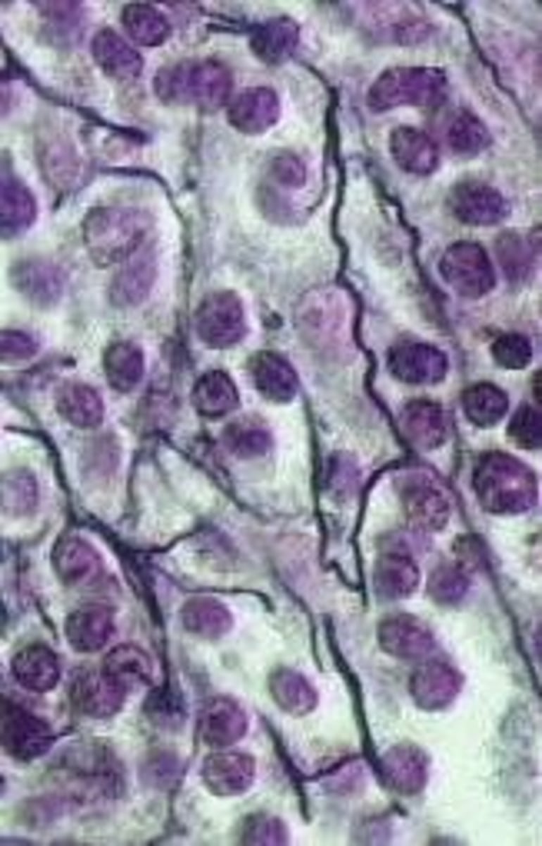 <p>small cells that have fibers passing between them. Fibers are short and thick</p><p>found making up the main portions of the liver, spleen, appendix, tonsils and lymph nodes</p><p>function: involved in making up the "framework" of the liver, spleen, appendix, tonsils and lymph nodes</p>