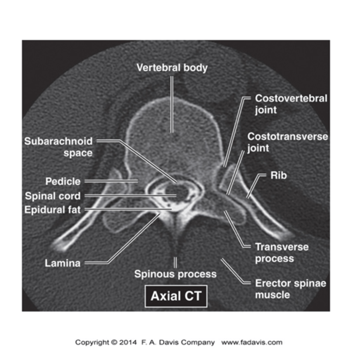 <p>xray- initially ordered</p><p>nuclear medicine bone scan- metastases</p><p>MRI- study of choice for spinal cord, intervertebral discs, compression of spinal nerves</p><p>CT- best for bony abnormalities, MRI contraindicated, non contrast for trauma</p>