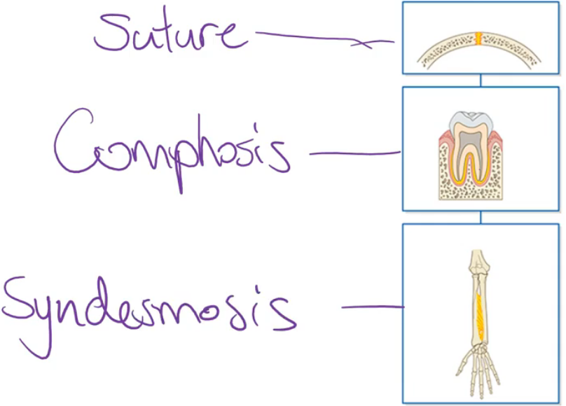 <ul><li><p>Do not have a joint cavity. The bones that participate in a fibrous joint are held together by strong connective tissue elements that are rich in collagen fibres</p></li><li><p>There are fibrous joint subtypes:</p><ul><li><p><strong>Sutures</strong></p></li><li><p><strong>Syndesmosis</strong></p></li><li><p><strong>Gomphosis joints</strong></p></li></ul></li></ul><p></p>