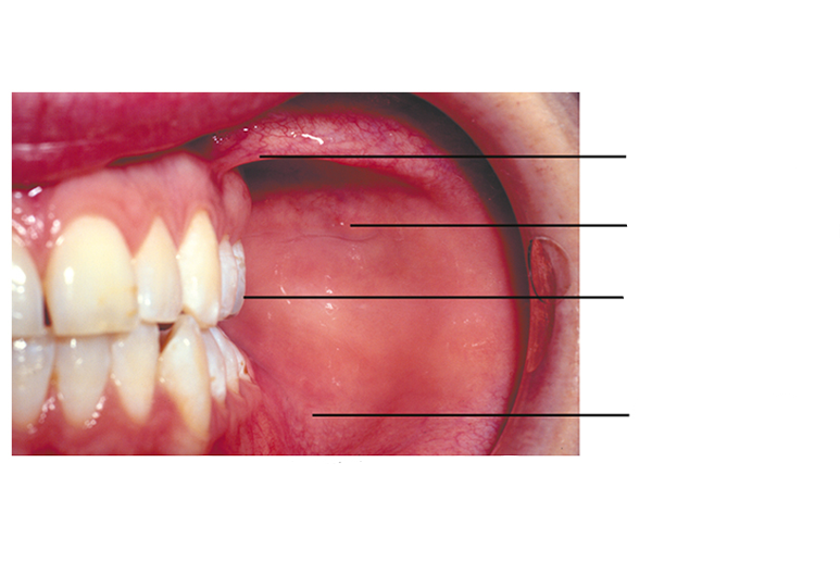 <p>Label from 1-4 </p>