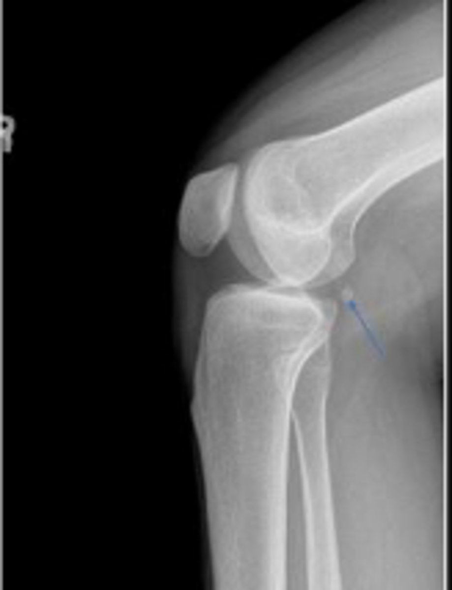 <p>What are the arrows pointing to?</p>